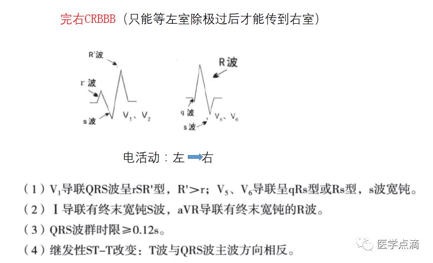 学习心电图必须掌握的基础知识，收藏起来慢慢看！