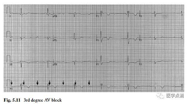学习心电图必须掌握的基础知识，收藏起来慢慢看！
