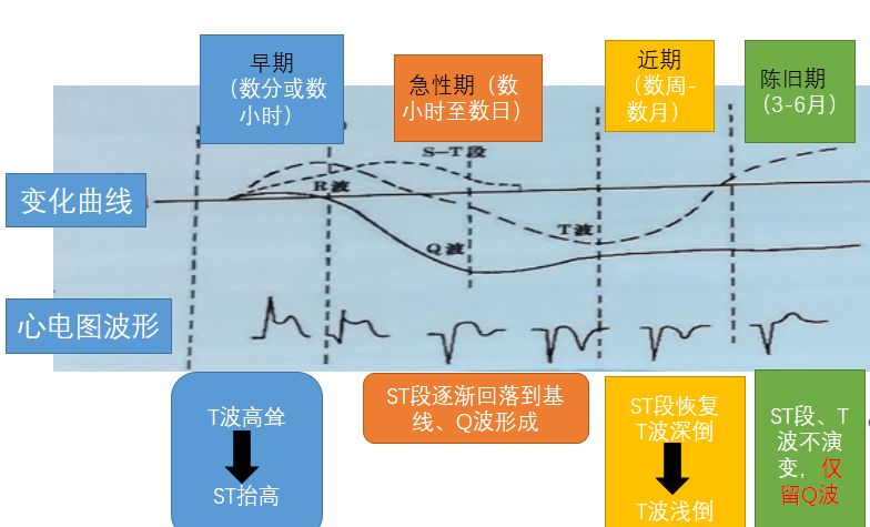 学习心电图必须掌握的基础知识，收藏起来慢慢看！