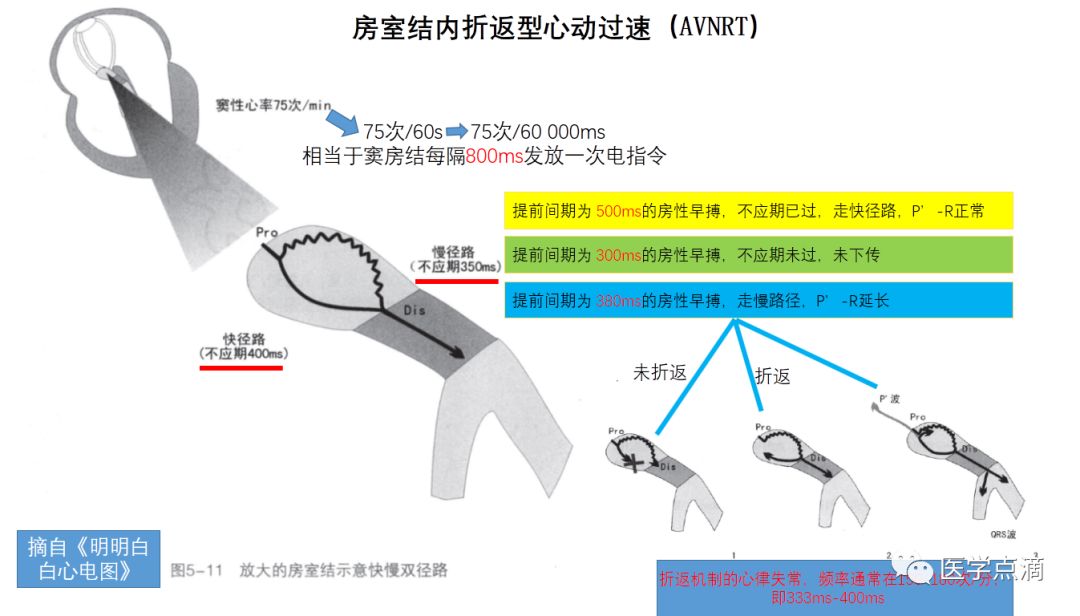 学习心电图必须掌握的基础知识，收藏起来慢慢看！