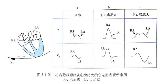 学习心电图必须掌握的基础知识，收藏起来慢慢看！