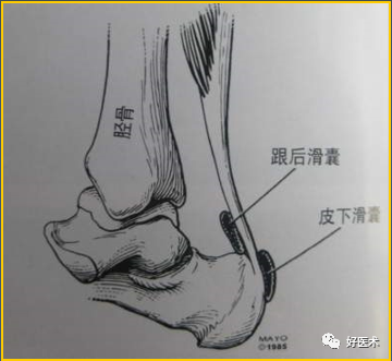 高清组图学踝关节韧带及相关影像诊断，想忘记都难！
