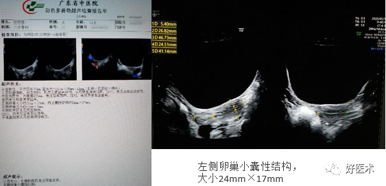 从影像诊断到手术治疗，全面讲解主任口中的“骨纤”！