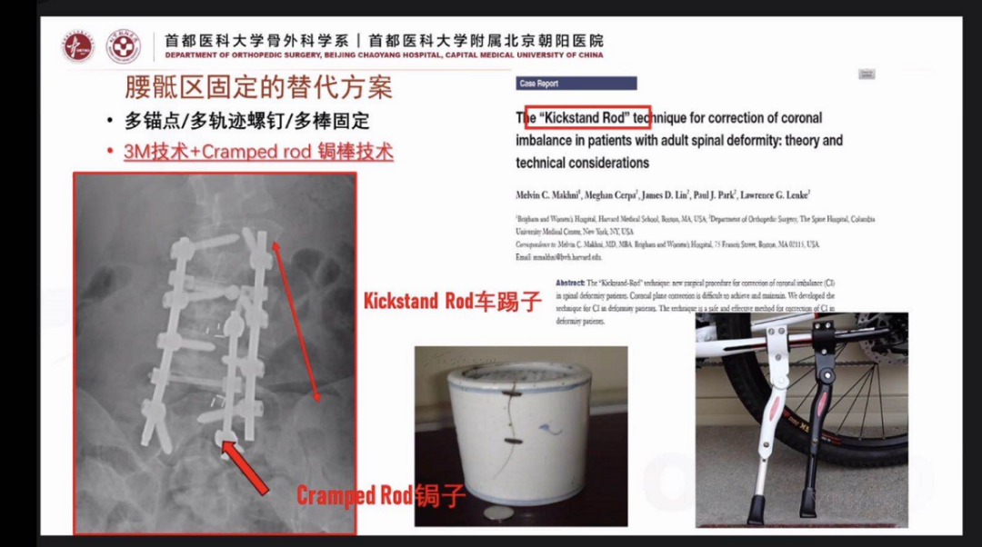 “睿技治畸”云端系列研讨会，圆满落幕！