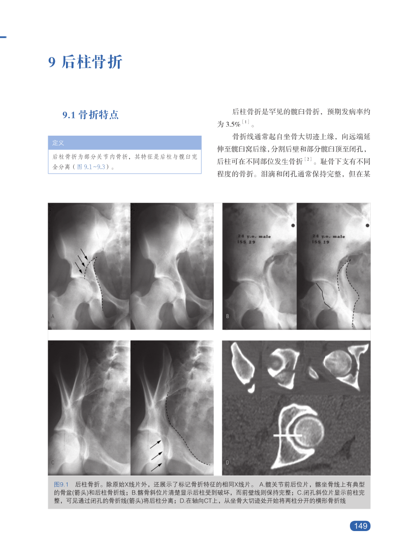 新书推髋臼骨折诊断、适应证与治疗策略，大咖思路都在这本书里！