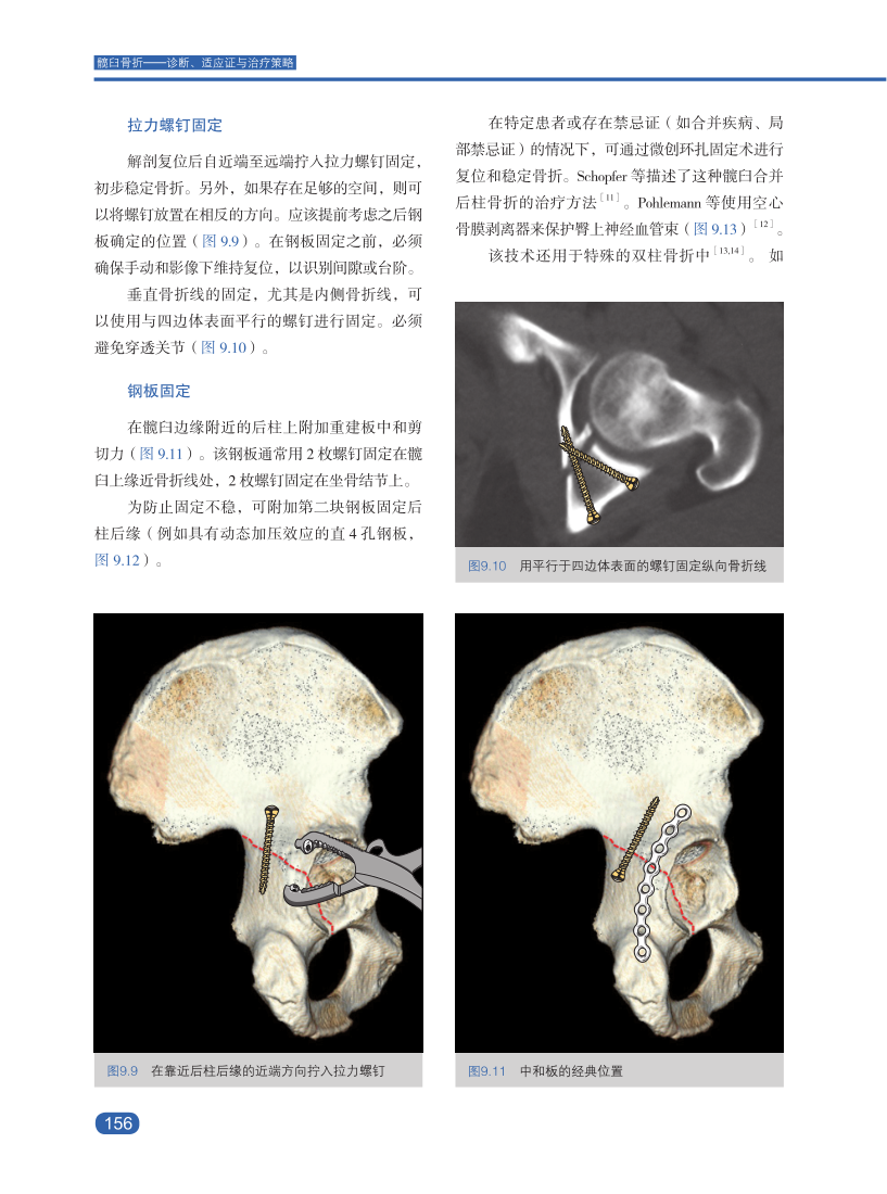 新书推髋臼骨折诊断、适应证与治疗策略，大咖思路都在这本书里！