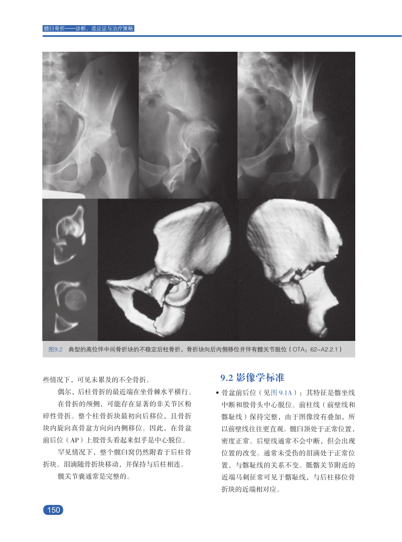 新书推髋臼骨折诊断、适应证与治疗策略，大咖思路都在这本书里！