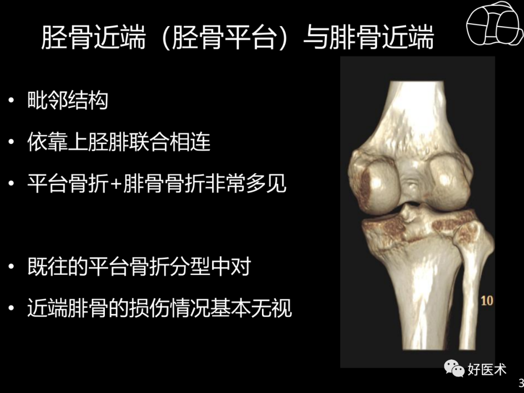 胫骨平台骨折伴随的6种腓骨柱损伤精讲，高清图文课件必看！