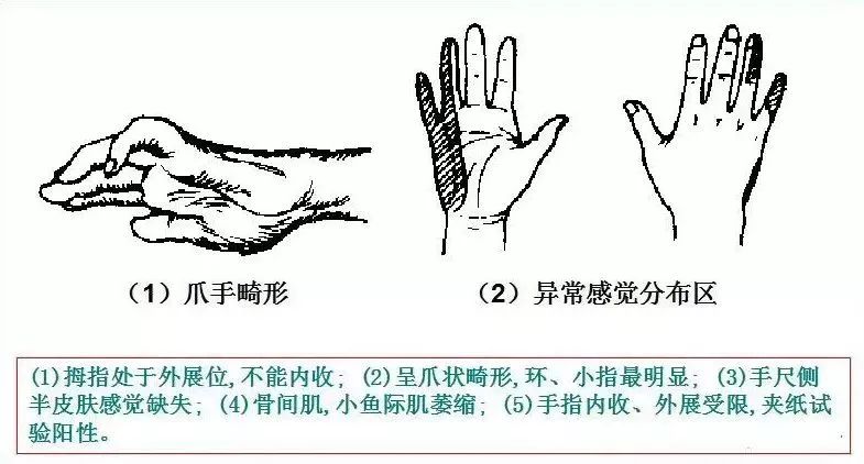 运动损伤检查及处理方法，此文非常实用！