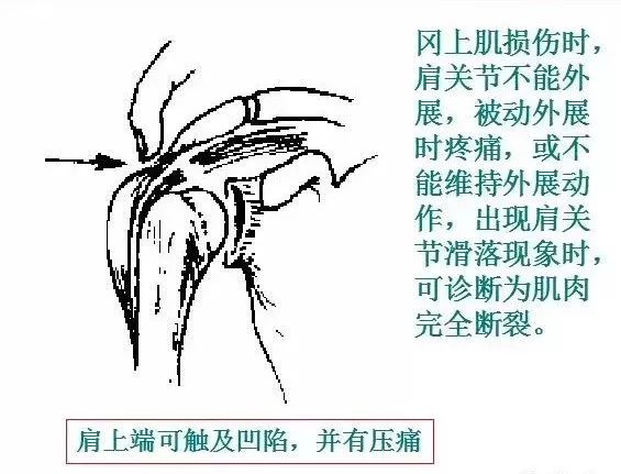 运动损伤检查及处理方法，此文非常实用！