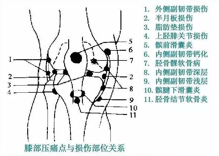 运动损伤检查及处理方法，此文非常实用！