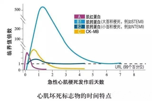 心肌梗死，ST段抬高型与非抬高型有什么区别？