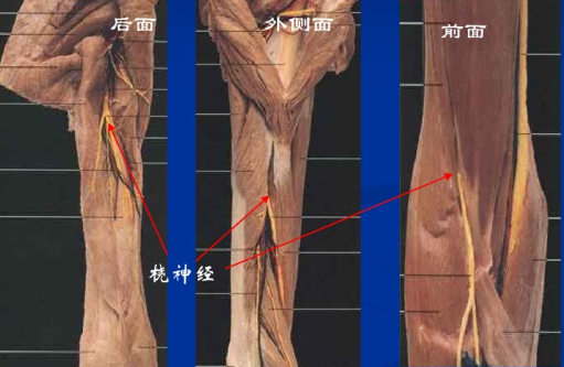 肱骨干骨折：局部解剖、手术入路、固定及手术全面精讲！