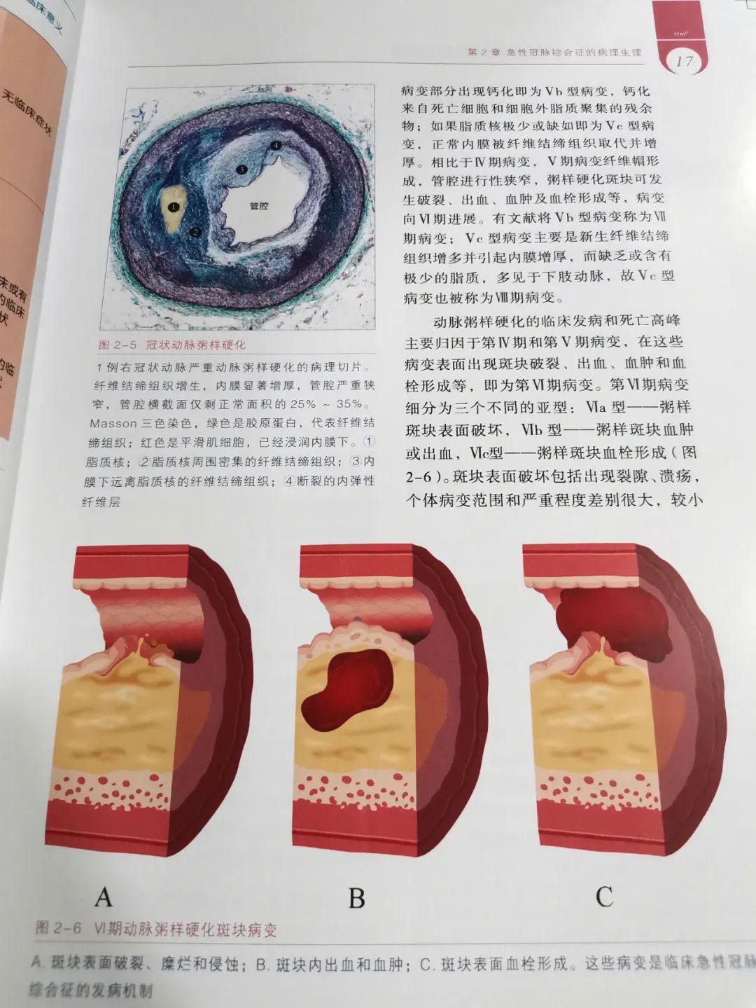 热销新书|