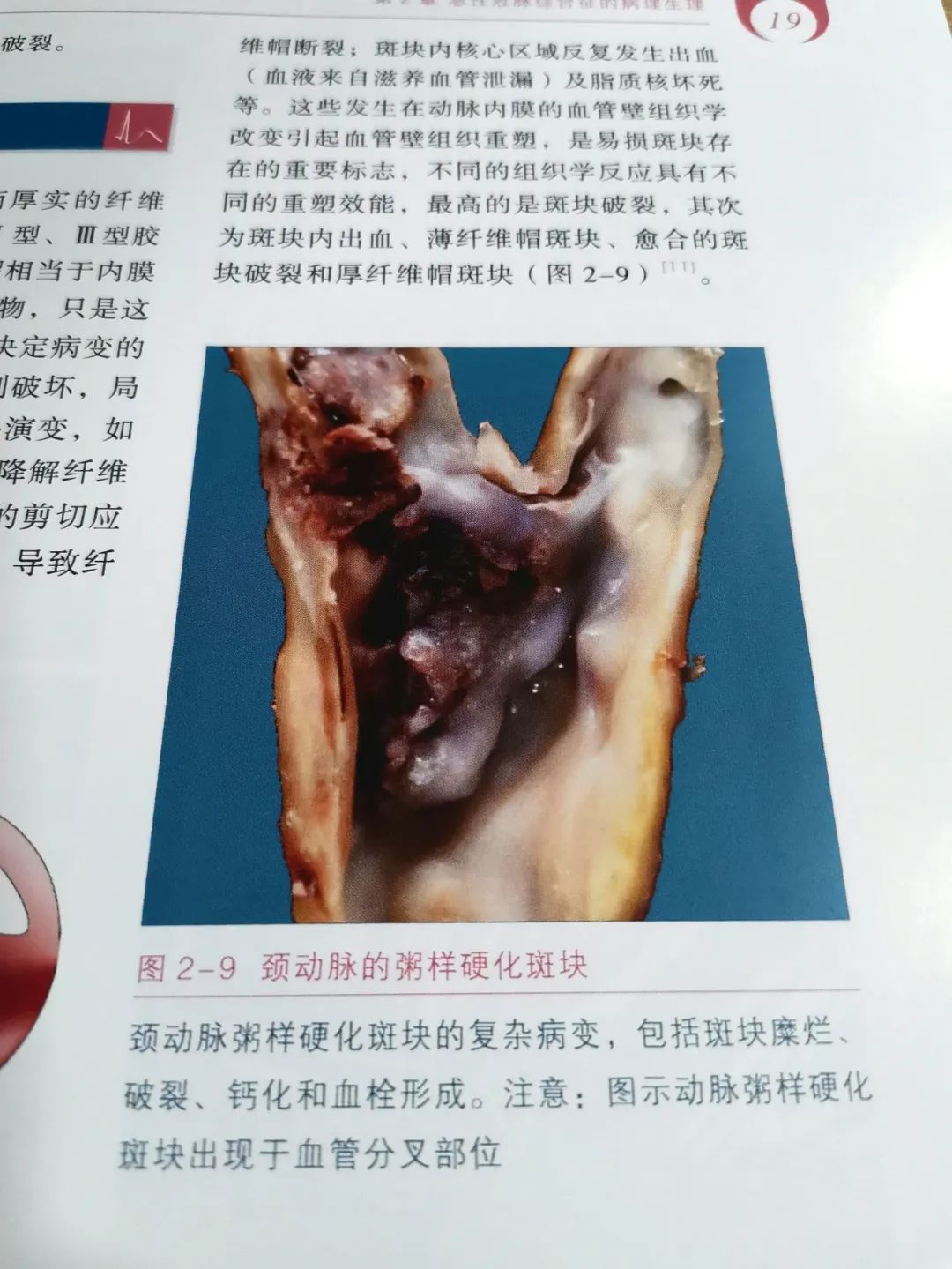 热销新书|