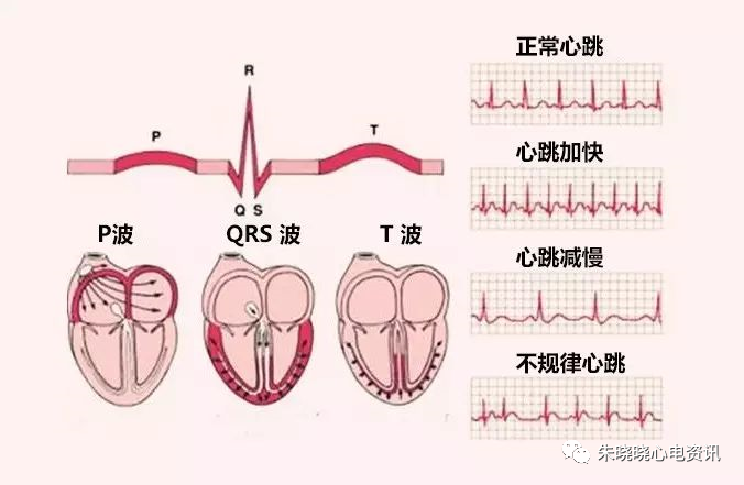 如何快速阅读心电图？记住这四步让你事半功倍！