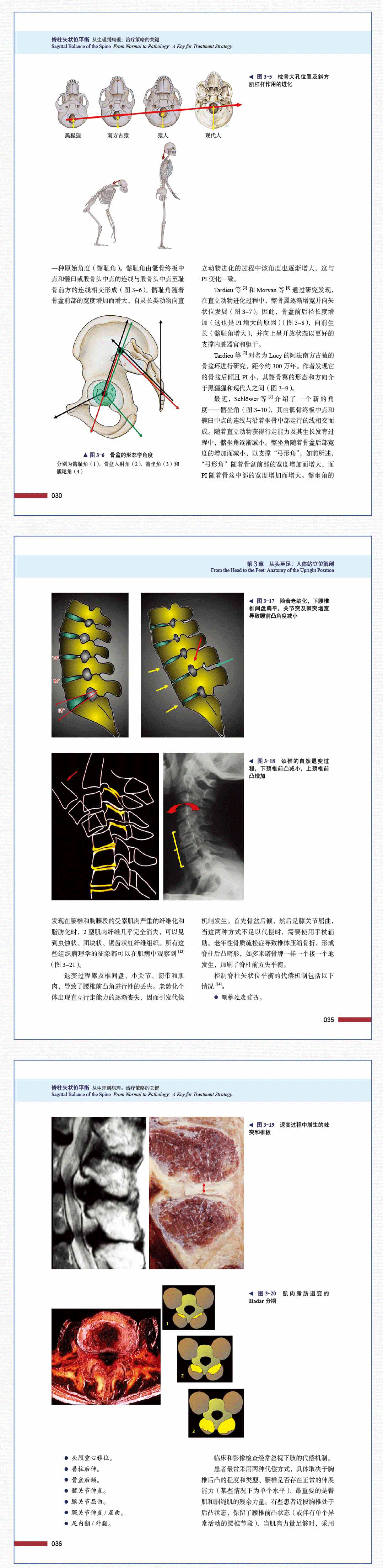 海涌教授领衔主译｜脊柱矢状位平衡--从生理到病理：治疗策略的关键