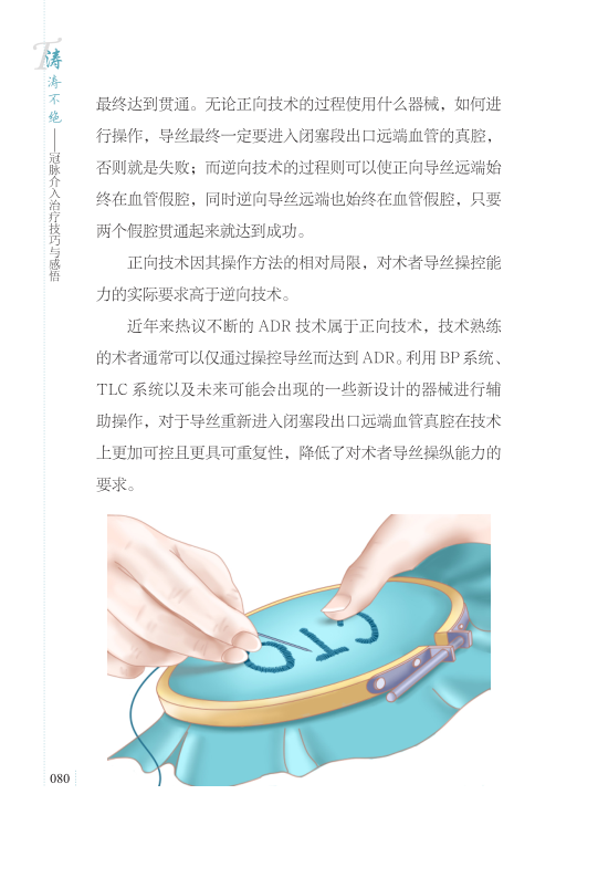 CTO胡涛新书：谈谈冠脉介入治疗技巧与感悟，现货包邮！