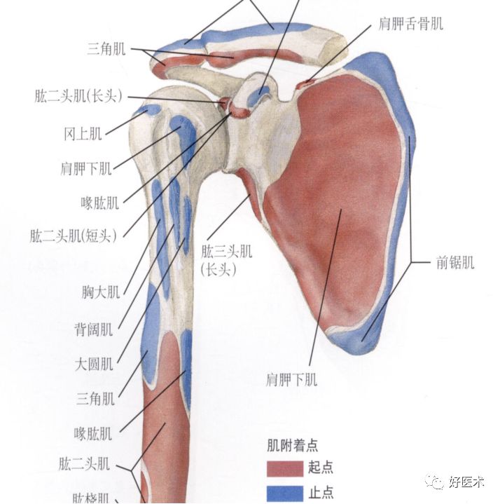 2肩外侧疼痛肩峰下滑囊炎钙化性冈上肌腱炎肩峰下撞击综合征3