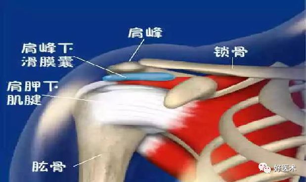 肩部疼痛患者，应考虑到的26种诊断！