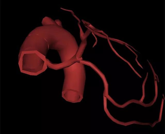高清3D图片，轻松理解冠脉造影体位！