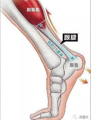 「足跟痛」并非都是骨刺惹的祸，14大“元凶”需警惕！