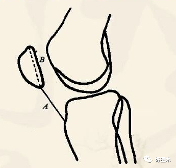 全身骨关节的基础数据，你还记得多少？