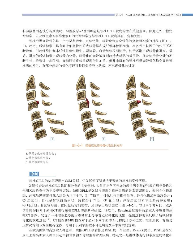 长征医院史建刚教授新书首发---颈椎前路ACAF技术！