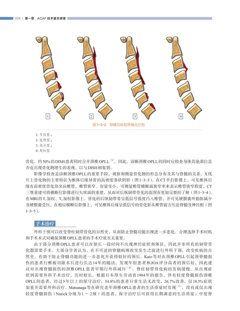 长征医院史建刚教授新书首发---颈椎前路ACAF技术！