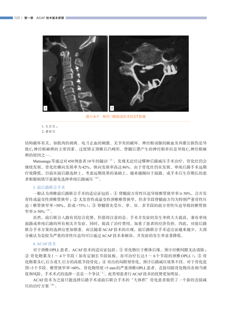 长征医院史建刚教授新书首发---颈椎前路ACAF技术！