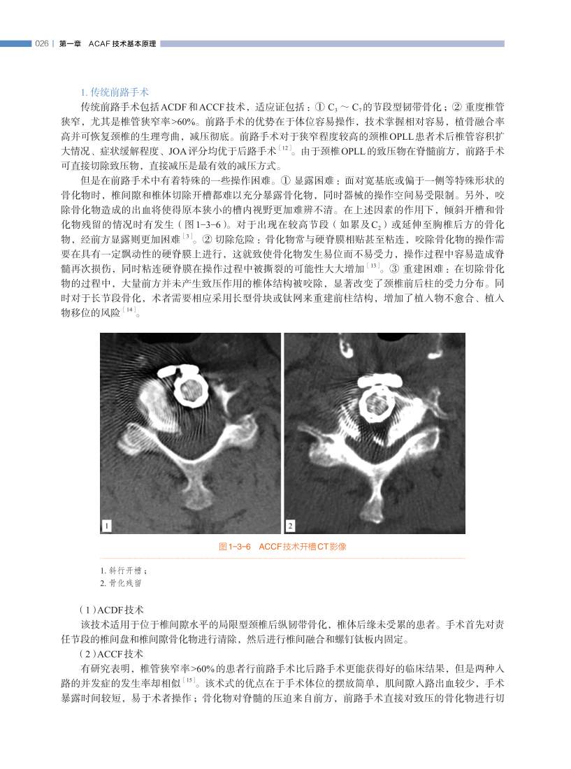 长征医院史建刚教授新书首发---颈椎前路ACAF技术！