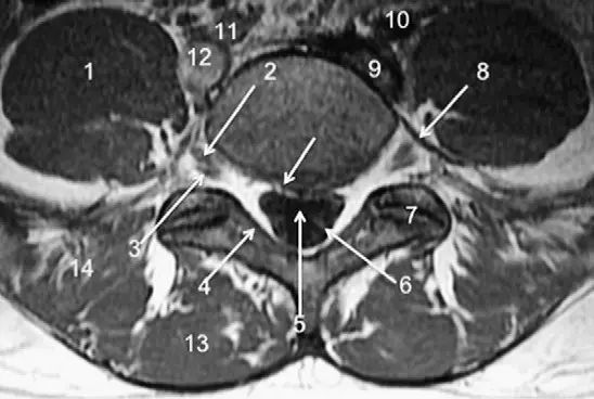 胸、腰椎MRI解剖，9张高清图注帮你速记!
