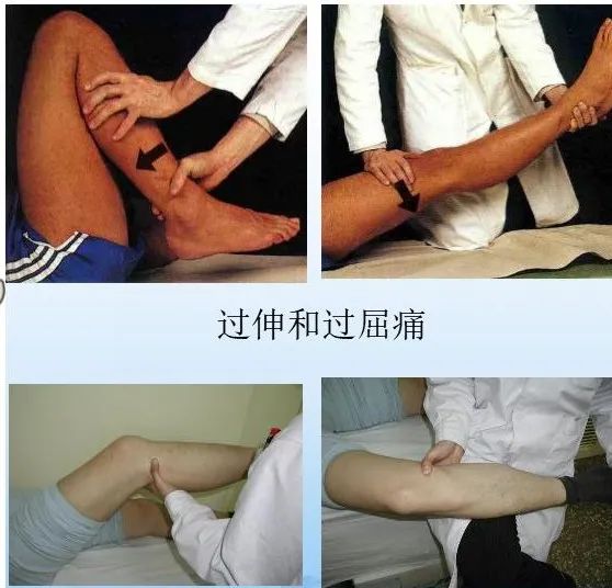 膝胫试验图片