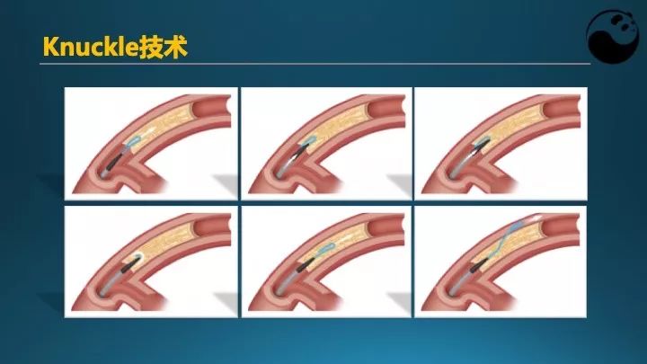 学习介入，连相关术语都听不懂怎么行