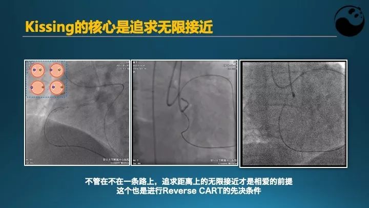 学习介入，连相关术语都听不懂怎么行