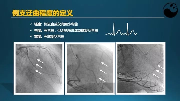 学习介入，连相关术语都听不懂怎么行