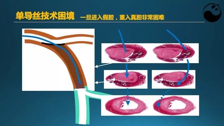 学习介入，连相关术语都听不懂怎么行