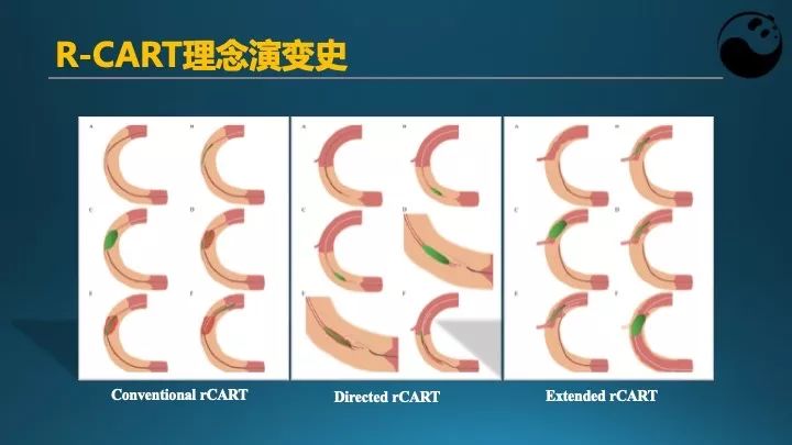 学习介入，连相关术语都听不懂怎么行