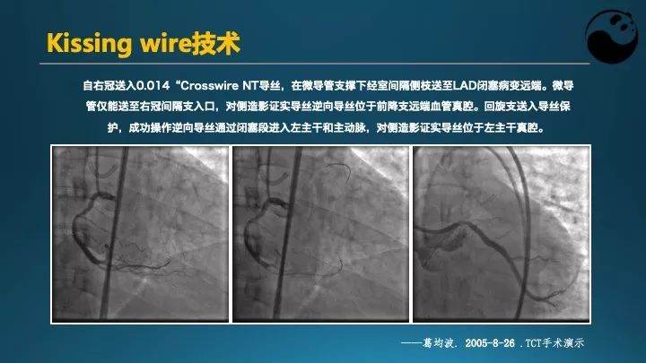 学习介入，连相关术语都听不懂怎么行