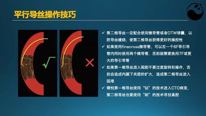 学习介入，连相关术语都听不懂怎么行