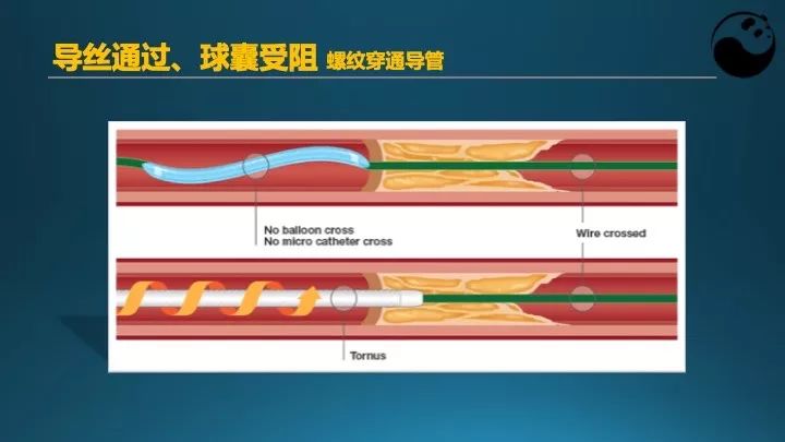 学习介入，连相关术语都听不懂怎么行