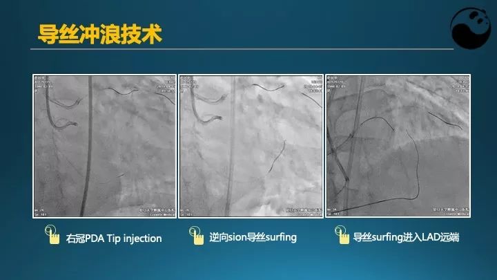 学习介入，连相关术语都听不懂怎么行