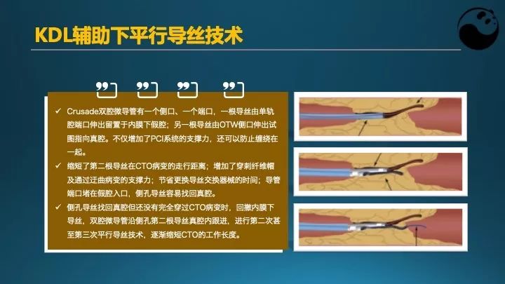 学习介入，连相关术语都听不懂怎么行