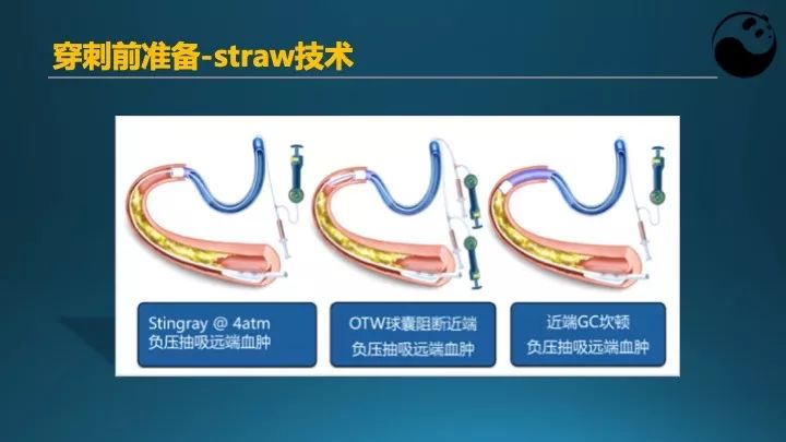 学习介入，连相关术语都听不懂怎么行