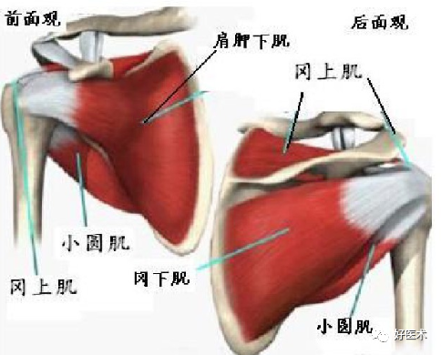 肩部疼痛就诊患者，65%都不是肩周炎惹的祸！