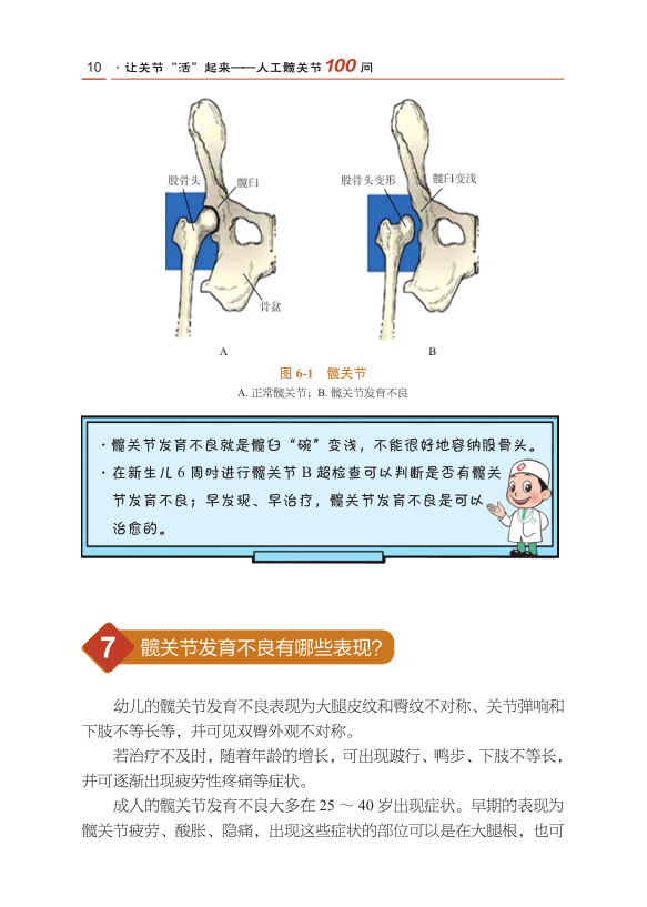 北大人民医院荣誉出品，让关节“活起来”人工关节100问（第2版）！