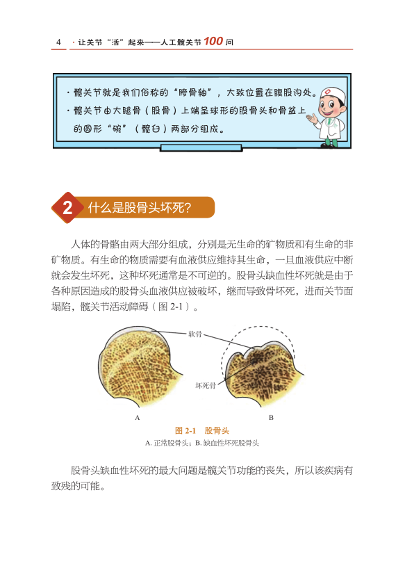 北大人民医院荣誉出品，让关节“活起来”人工关节100问（第2版）！