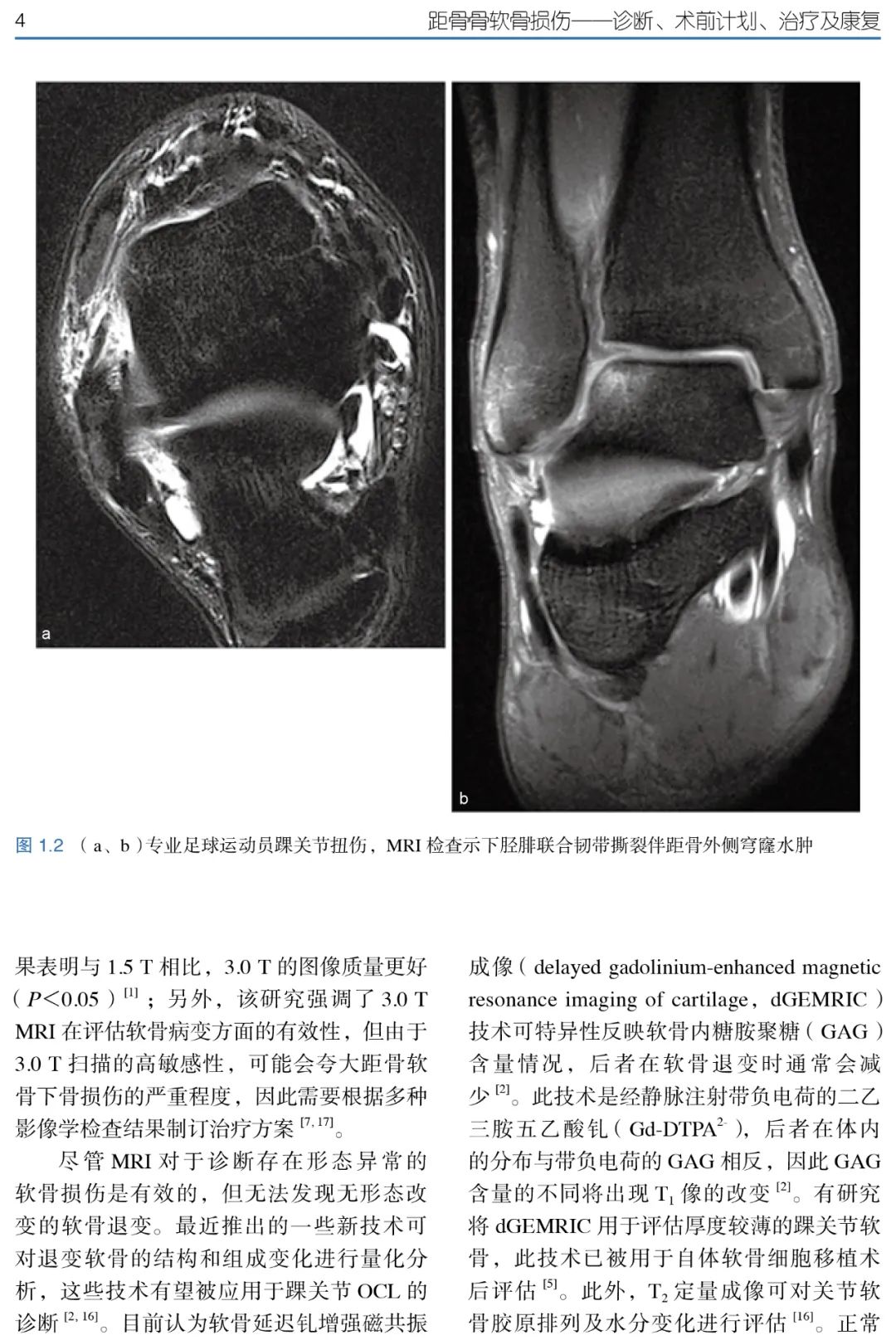 骨科医生诊治距骨骨软骨损伤的临床指南，欲购从速！