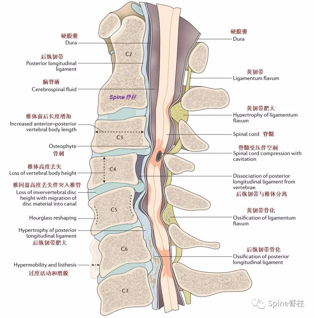 没掌握这些知识，别说你懂颈椎病！