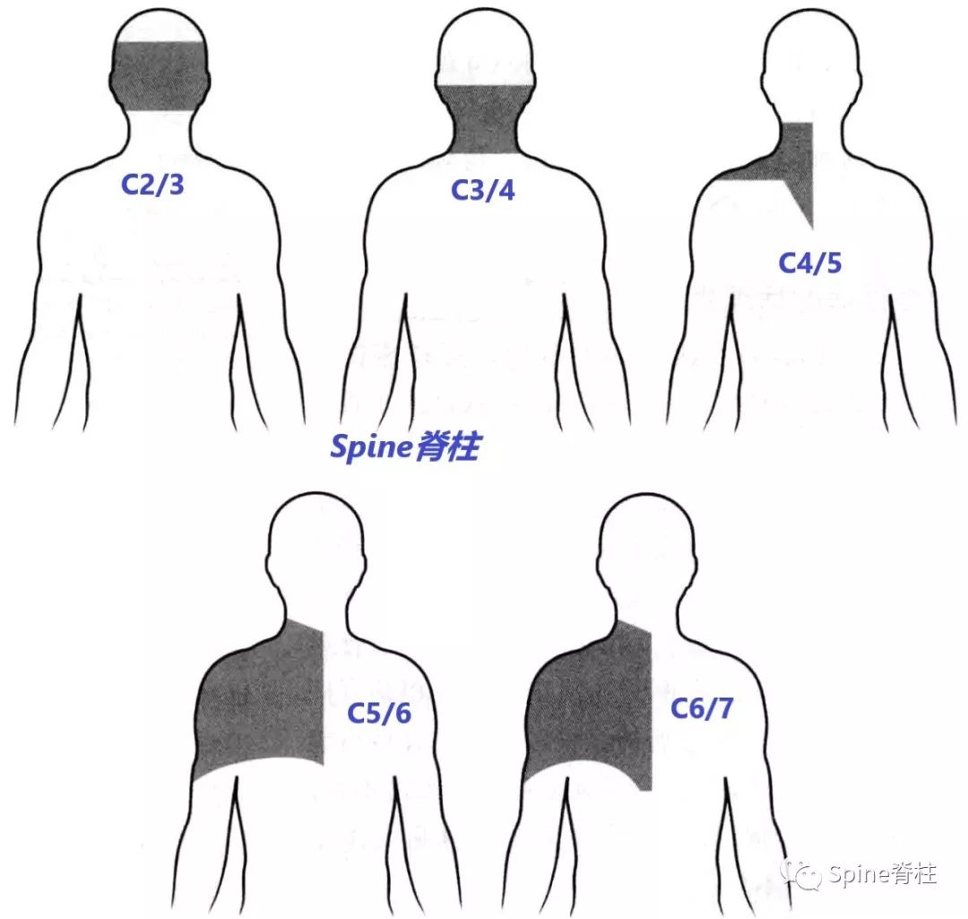 没掌握这些知识，别说你懂颈椎病！